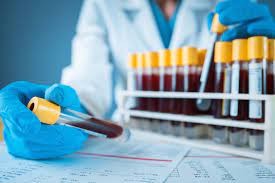 Lab Test